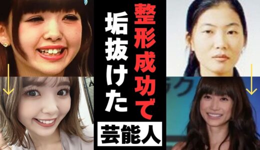 【有益2ch】決め手は引き算！美容整形が大成功して垢抜けた芸能人【ガルちゃん】
