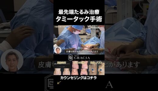 切るたるみ治療 タミータック手術 #美容整形 #たるみ #整形