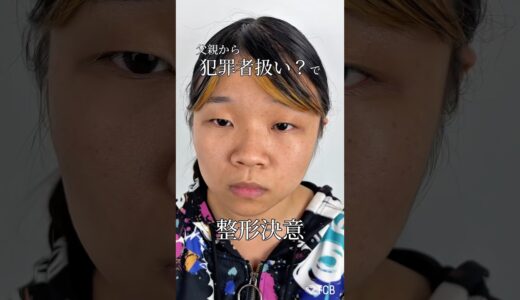 【クマ取り】父親から犯罪者扱い？で整形決意 #shorts