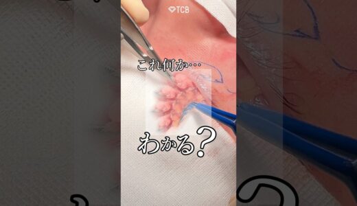 【クマ取り】これ何かわかる？#shorts