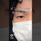 【二重整形】メンズの二重はあり？なし🤔💭？#shorts