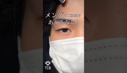 【二重整形】メンズの二重はあり？なし🤔💭？#shorts