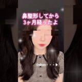 自然に団子鼻改善🍀　#形成外科専門医 #美容整形 #美容 #鼻整形 #整形 #だんご鼻 #団子鼻