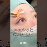 【二重整形】ニュルっと何が出てきた？#shorts