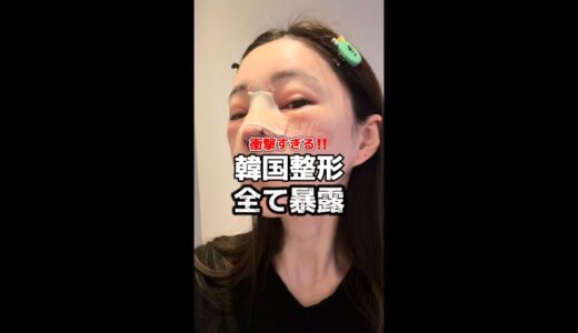 衝撃すぎる‼️韓国整形全て暴露