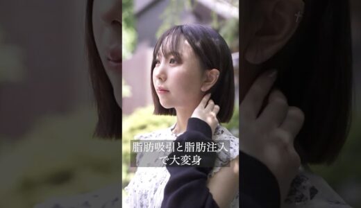あなたは気づく？この美人、整形です #美容整形 #脂肪吸引 #輪郭整形 #脂肪注入
