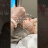 案件なし！美容クリニックvlog #vlog #美容 #美容整形 #アンチエイジング