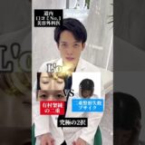 みんなは共有から2番目だれだった？ #美容 #整形