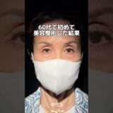 【クマ取り】60代で初めて美容整形した結果… #shorts