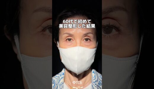 【クマ取り】60代で初めて美容整形した結果… #shorts