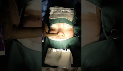 鼻フル解説&before/After𖥔 ࣪⸝⸝꙳#美容整形 #鼻フル #鼻整形 #shorts #解説
