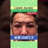 【若返り】40代男性がクマ取り＆眉下リフトに挑戦！【Men’s】#Shorts
