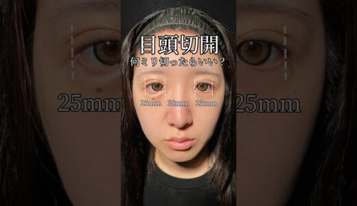 目頭切開って何mm切ったらいいの？#shorts #二重整形 #目頭切開 #整形 #美容整形 #ダウンタイム#東京 #池袋
