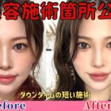【美容整形】最近顔が垢抜けた理由を教えます‼️