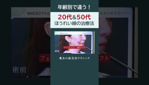 【ほうれい線】年齢別の効果的な治療法を解説 #shorts #水の森美容クリニック #美容整形 #美容 #水の森美容外科