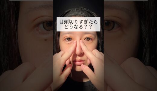 目頭を切り過ぎたらどうなる？？#shorts #二重整形 #目頭切開 #ダウンタイム #整形 #東京 #池袋 #蒙古襞