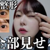 【二重修正】ダウンタイムまで全部見せる