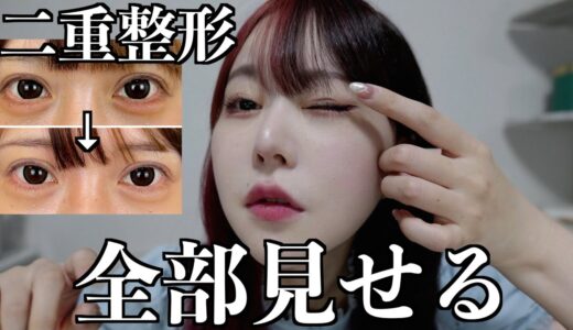 【二重修正】ダウンタイムまで全部見せる