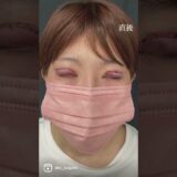【勇気を出して目を切開した結果】#湘南美容クリニック#切開法 #ダウンタイム #二重整形 #二重整形経過#二重になりたい
