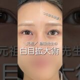 白目拡大術で加工級の変化 #shorts #美容 #整形