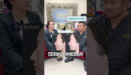 【村松先生】のスタッフ対談！鼻整形フルセットのリアルな感想と嬉しい変化を先生に報告♪ #湘南美容クリニック #鼻整形  #美容