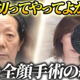 実の母親を手術【後編】別人?! 73歳がマイナス20歳に★【たるみ治療・リフトアップ・アンチエイジング】