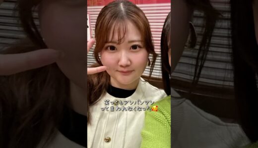 脱アンパンマンで垢抜けた👶🏻🎀#美容 #美容整形 #ダウンタイム #脂肪吸引 #整形 #垢抜け