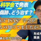 美容外科学会で発表　美容整形後の傷跡、どう直す？