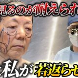 実の母親の全顔を手術・73歳の母、切開による顔のフルリフトアップに密着【前編】【たるみ治療・リフトアップ・アンチエイジング】