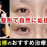 【二重整形】美容初心者におすすめ！自然に垢抜けるプチ整形２選【水の森美容クリニック】#二重埋没法#涙袋のヒアルロン酸