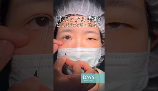 【目フル整形】整形の限界に挑戦！#shorts
