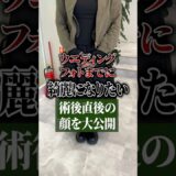 術後直後のビフォーアフター✨ #美容整形 #毎日投稿#ダウンタイム#クマ取り#大阪#心斎橋