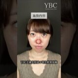 念願の鼻整形したら… #美容整形 #整形 #鼻整形