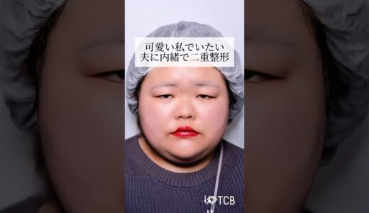 【二重整形】可愛い私でいたい 夫に内緒で二重整形 #shorts