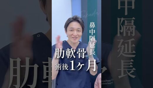 アップノーズ改善　#形成外科専門医 #美容 #鼻整形 #アップノーズ #肋軟骨 #鼻中隔延長