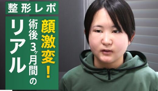【美容整形版令和の虎】術後の腫れに密着！土屋さん輪郭手術のその後