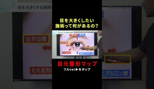 【整形初心者必見】目元整形マップ🗺️  #整形 #二重整形 #埋没