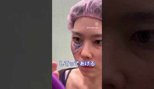 #美容整形 #裏ハムラ #ミッドフェイスリフト