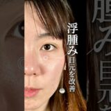 【クマ取り】浮腫み目元を改善！#shorts #美容整形 #美容 #整形 #クマ取り
