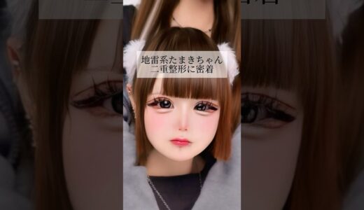 【二重整形】#shorts 地雷系女子の二重整形に密着