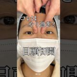 【二重整形】コレはやり過ぎ？目頭切開#shorts