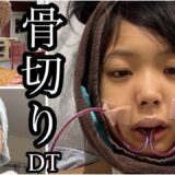 【キラキラ美容師両顎骨切りしてきた】壮絶DTと整形アンチにあいりのオペへの気持ち見て欲しい