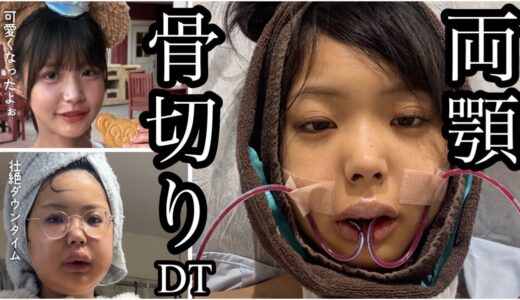 【キラキラ美容師両顎骨切りしてきた】壮絶DTと整形アンチにあいりのオペへの気持ち見て欲しい