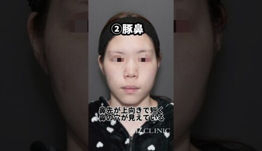 【鼻整形】あなたの鼻はどのタイプ？#shorts
