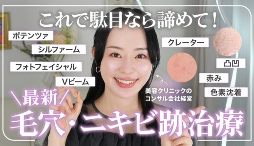 【最新ニキビ＆ニキビ痕治】美容医療のプロが教える！お悩み別、今ニキビ跡を治すならこの治療です【クレーター・ニキビ痕の赤み】