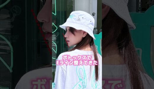 顎ボトックスでEラインを整える #美容整形 #shorts #整形