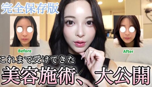 【完全保存版💎】受けてきた美容施術まとめ💉✨️ Before→Afterも大公開！