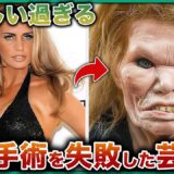 【衝撃】世界最悪の芸能人整形失敗10選！手術ミスで”顔面カオス”の恐怖！1位は人型怪物レベルでファンが失神した衝撃映像！