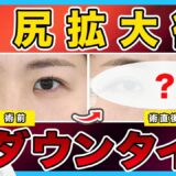 【美容整形】目尻拡大術のダウンタイムの経過を徹底解説