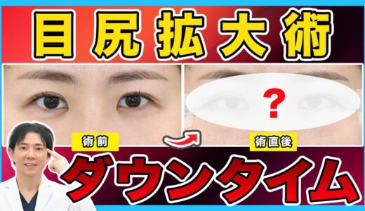 【美容整形】目尻拡大術のダウンタイムの経過を徹底解説
